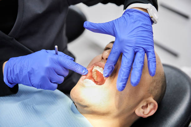 Best Emergency Dentist for Knocked-Out Tooth in Pelham, GA