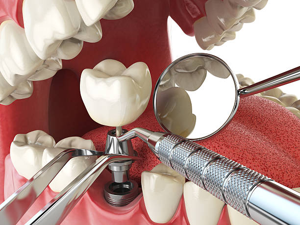 Best Broken or Cracked Tooth Emergency Dentist in Pelham, GA
