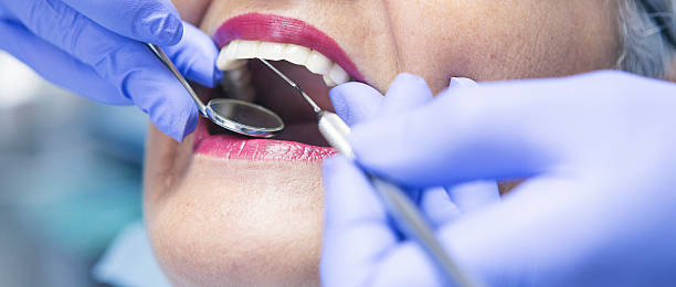 Best Emergency Dentist for Lost Fillings or Crowns in Pelham, GA